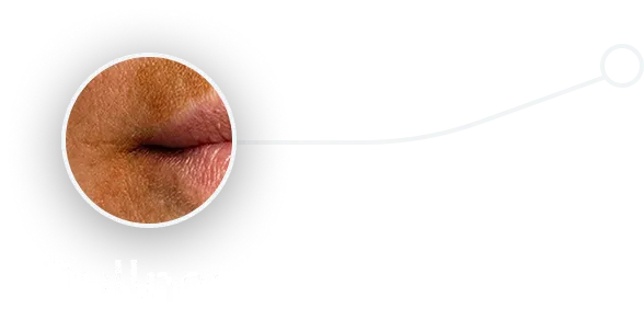 dullness